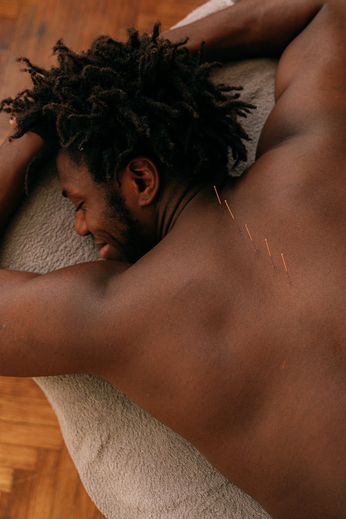 Acupuntura é muito mais do que tratar sintomas: entendendo seu papel na promoção da saúde e da qualidade de vida A man receiving acupuncture treatment, focusing on wellness and relaxation.