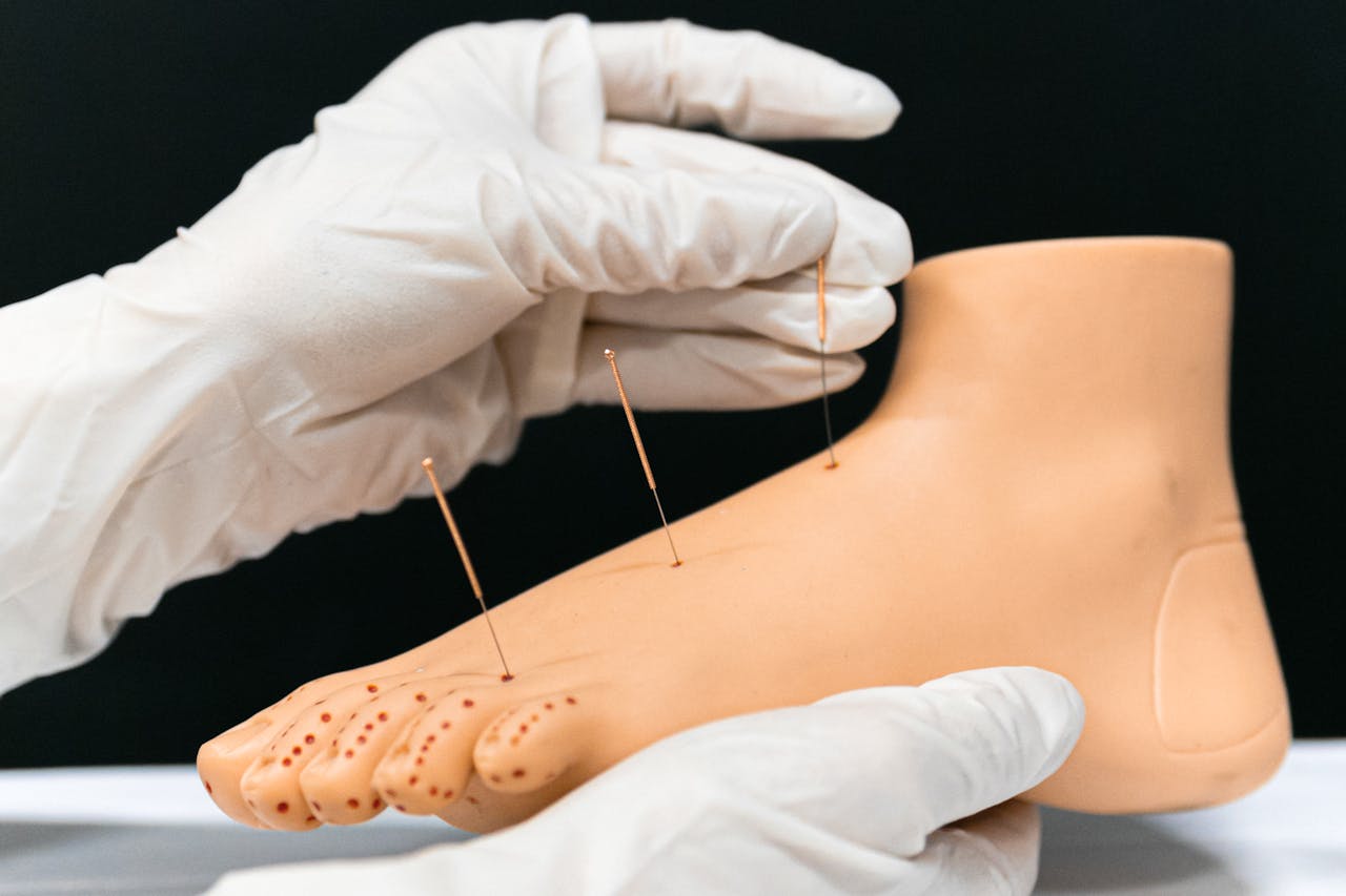 Close-up of a foot model with acupuncture needles inserted, demonstrating alternative therapy.
