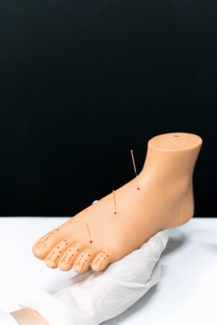 Acupuncture foot model with needles for alternative therapy demonstration.
